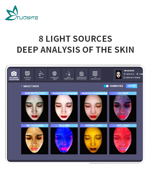 3D Facial Skin Analyzer