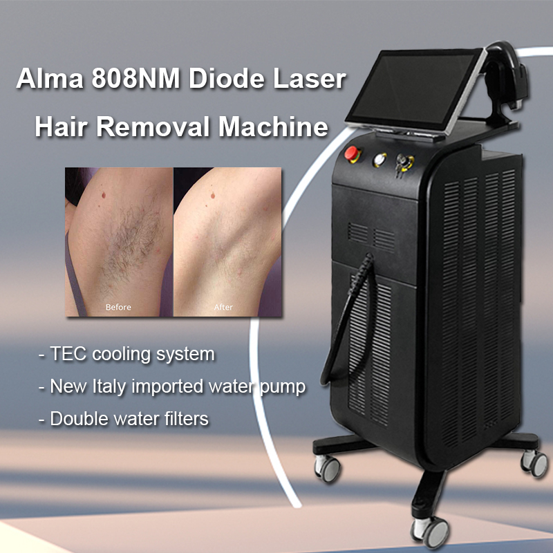 alma 808 diode laser hair removal machine