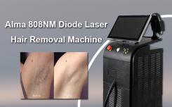 What is the process of permanent laser hair removal?